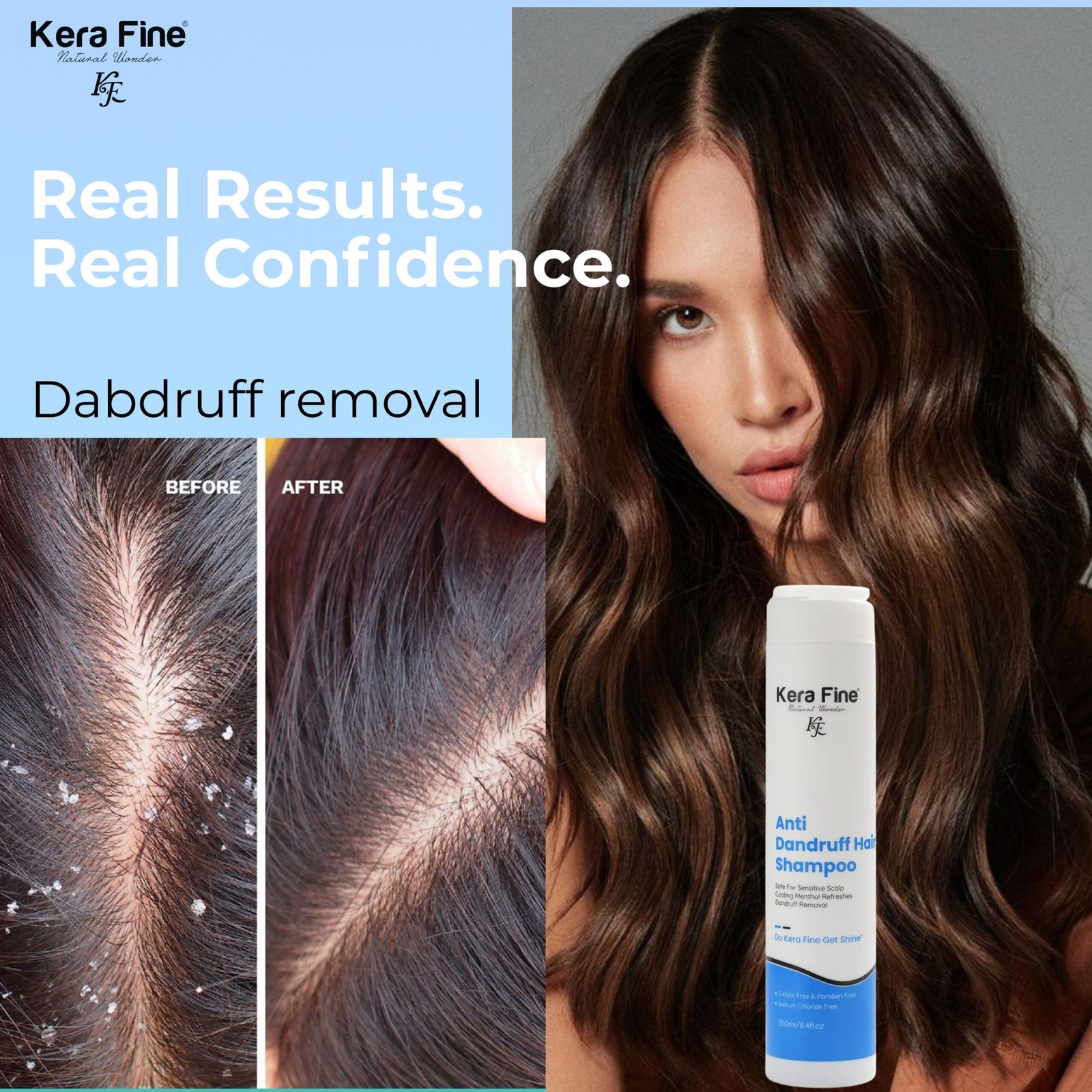 Anti Dandruff Shampoo